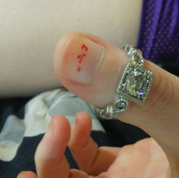 Ring - Picture 6 of 8